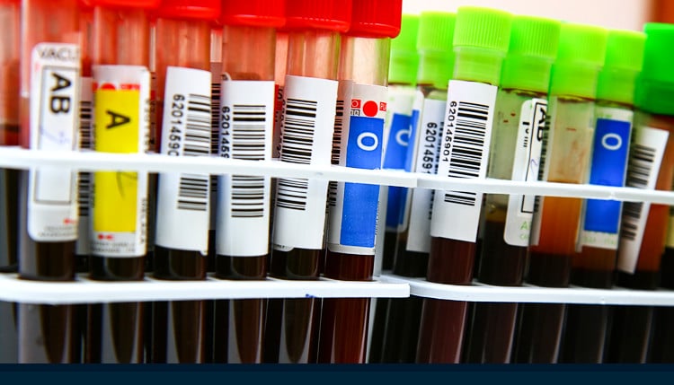 Armazenamento de sangue antes da análise clínica - Qual a temperatura correta?